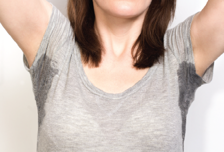 Treating  Axillary Hyperhidrosis with Botox