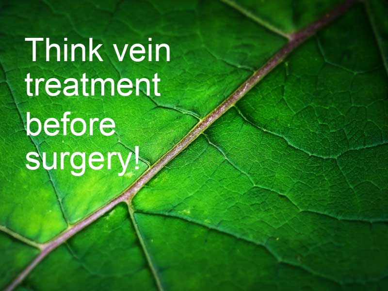 Varicose veins treatment before surgery – show on a green leaf