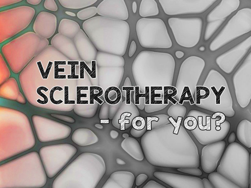 vein sclerotherapy text on graphic of veins
