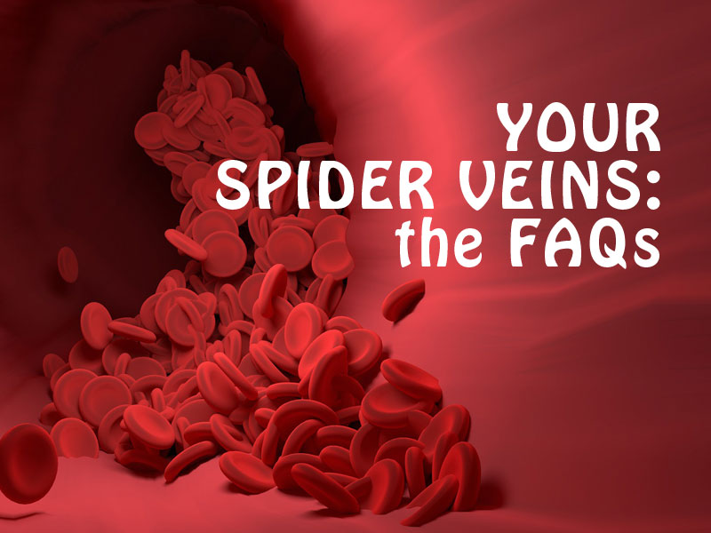 illustration of a blood vessel to back up your spider veins FAQs