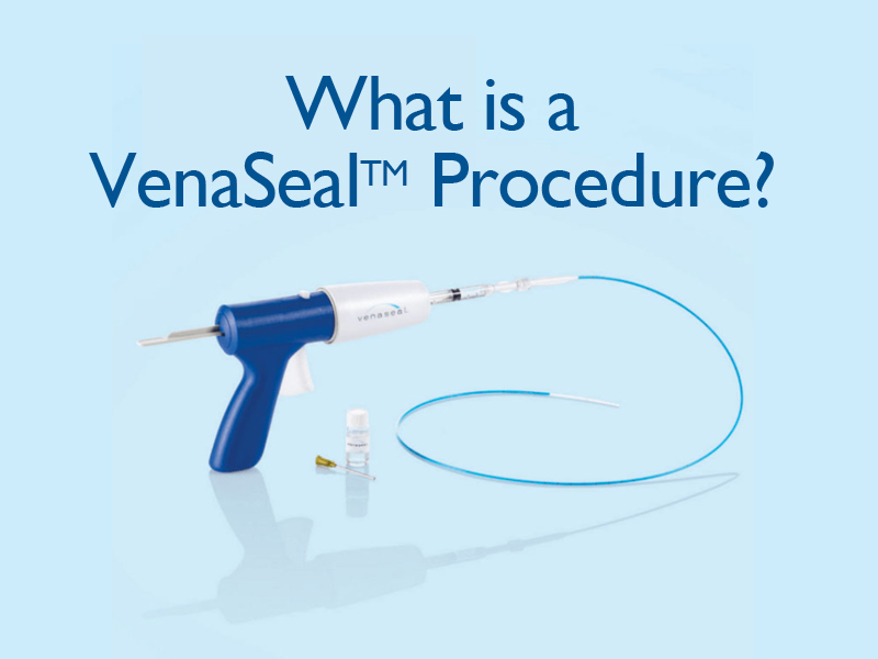 equipment for VenaSeal varicose vein treatment